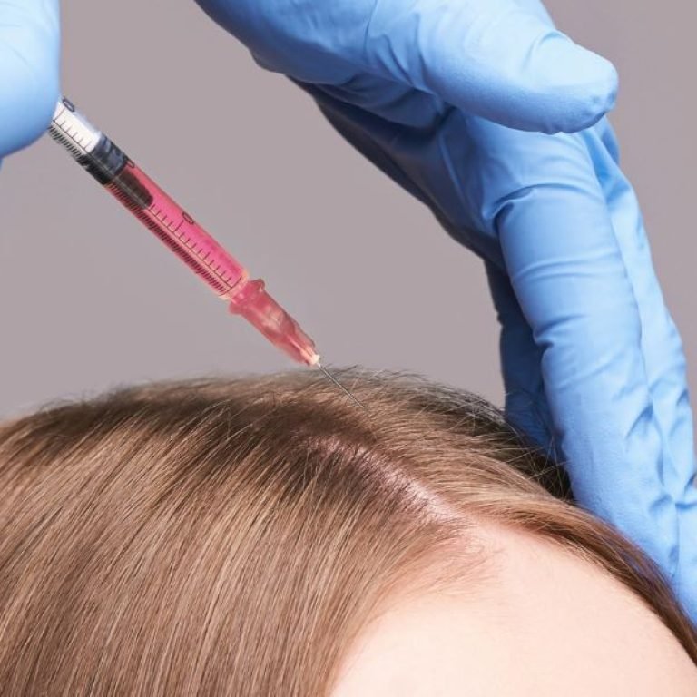 Eksozom-Sac-Tedavisi-Fiyatlari