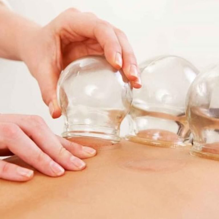 Hacamat-Nedir-Hacamat-Tedavisi-Irfan-Koca